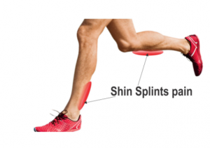 Shin Splints Chicand Fit